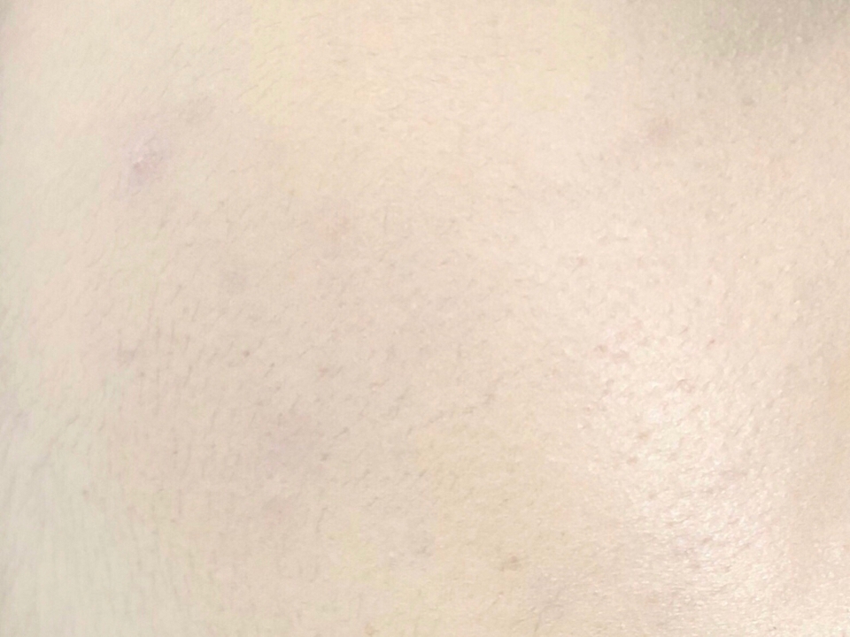 직접 화장을 해보니, 모공도 붉은기도 잡티도 자연스럽게 커버가 되는 모습을 볼 수 있었어요!!!

커버 쿠션인데도 답답하지 않고 촉촉 + 은은한 광채까지 돌아서 너무 좋았어요 😍👍🏻❣️

📍제가 사용해보고 느낀 한 가지 팁은 양 조절을 잘 해야 한다는 점입니다💕 퍼프로 살짝 찍은 양으로도 얼굴 전체에 얇게 펴바를 수 있었어요~

아무래도 커버쿠션이다보니 너무 많이 바르게 되면 조금 두껍게 발려 답답해보이더라구요🤔‼️