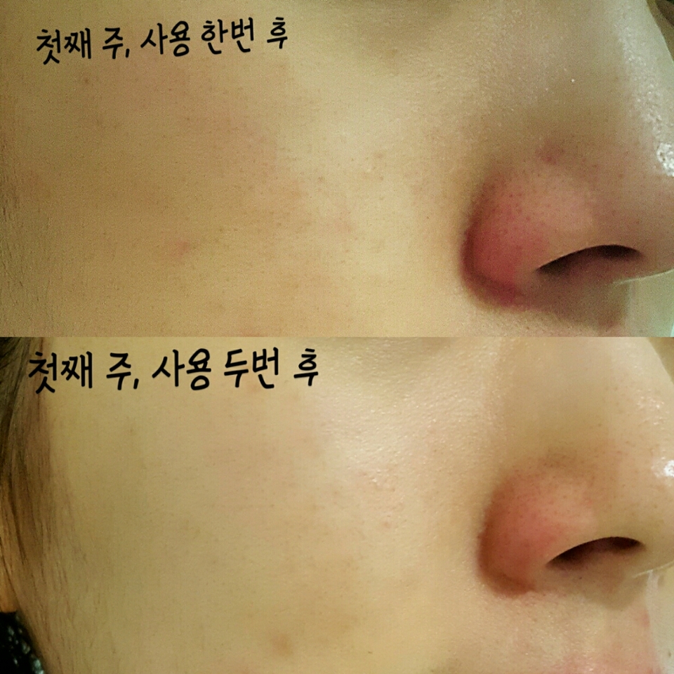 사용 전에는 세안후 푸석푸석하고 화장도 그럭저럭 먹는 반면에

사용 후에는 세안후에 건조함과 당김도 줄어들고 화장이 정말 잘먹어요 🖒
