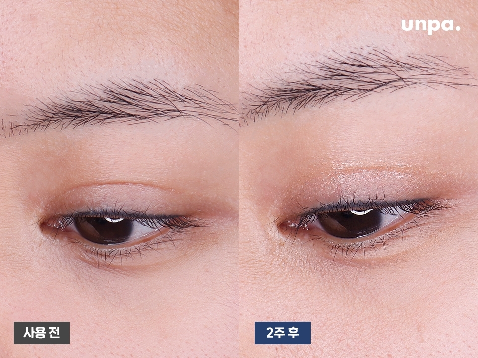 실제로 2주간 제품을 꾸준히 사용해봤는데 에디터의 퀭하고 
칙칙했던 눈가에 생기가 돌고 눈을 자주 비비는 습관으로
생긴 잔주름 사이에 영양감이 차오르면서 촉촉하게 
마무리되고 좀 더 피부가 팽팽하게 개선된 느낌이 들었어!
