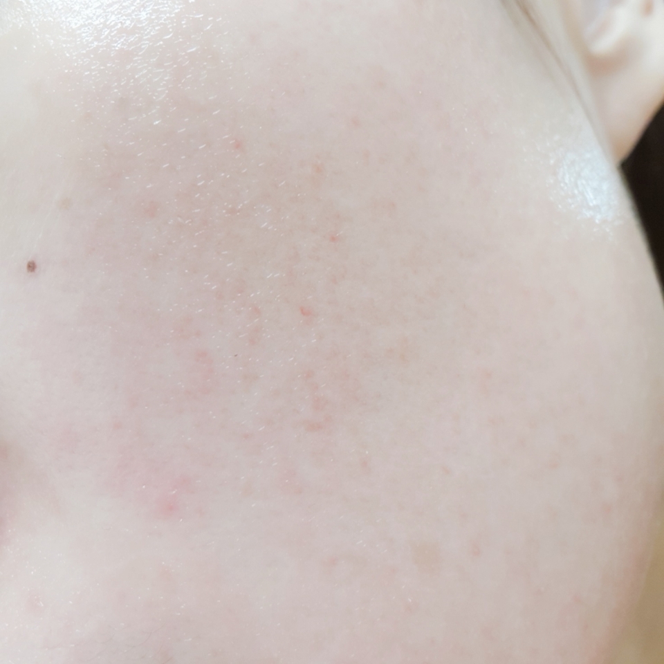 After 저녁보다는 아침에 사용하면 좋을것같아요