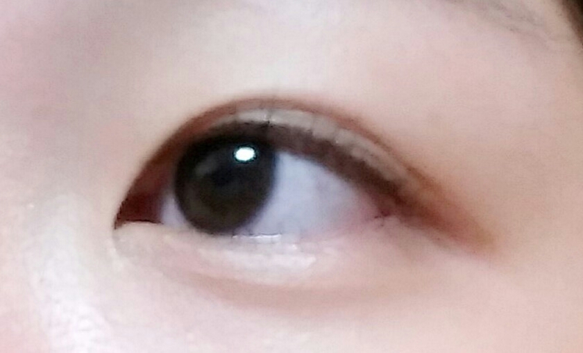 이런식으로 약간 쌍커풀안쪽으로 주름이보여요