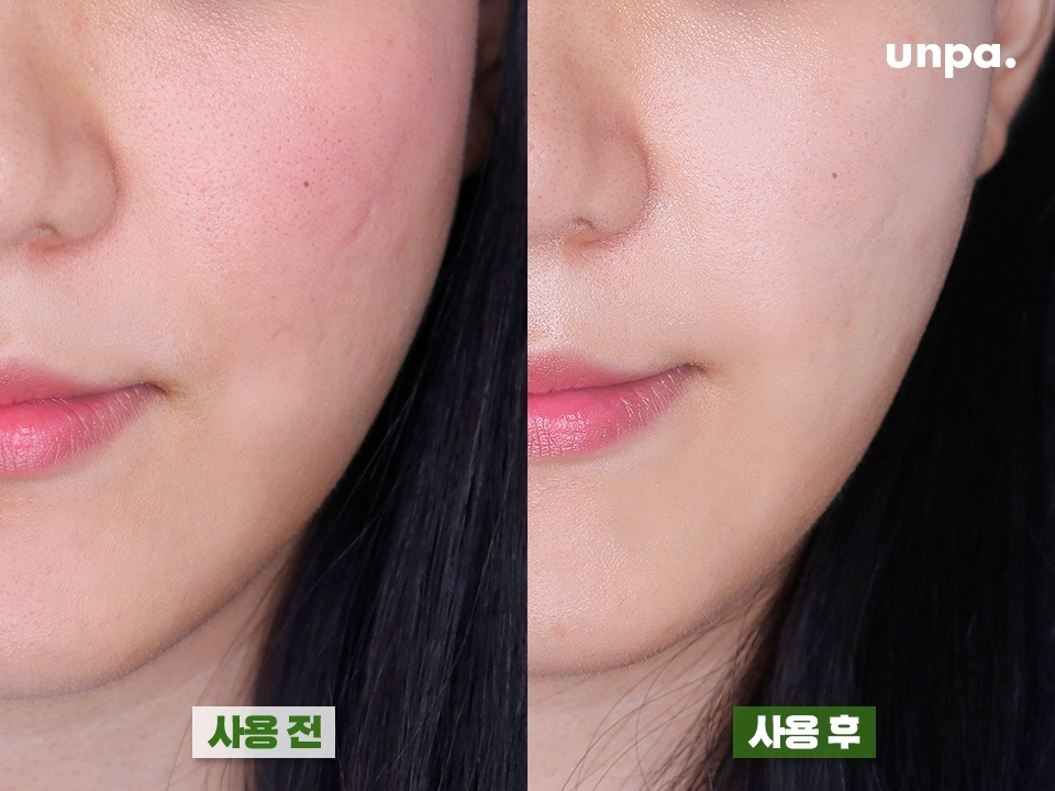 울트라 밤 크림으로 일주일 간 관리해주었더니
울긋불긋했던 피부가 싹-! 가라앉은 거 보이지?
감초, 녹차, 병풀 등 깐깐하게 엄선된 7가지 식물 성분이 들어있어! 
특히 감초는 아토피 피부에 좋은 거 알지?
