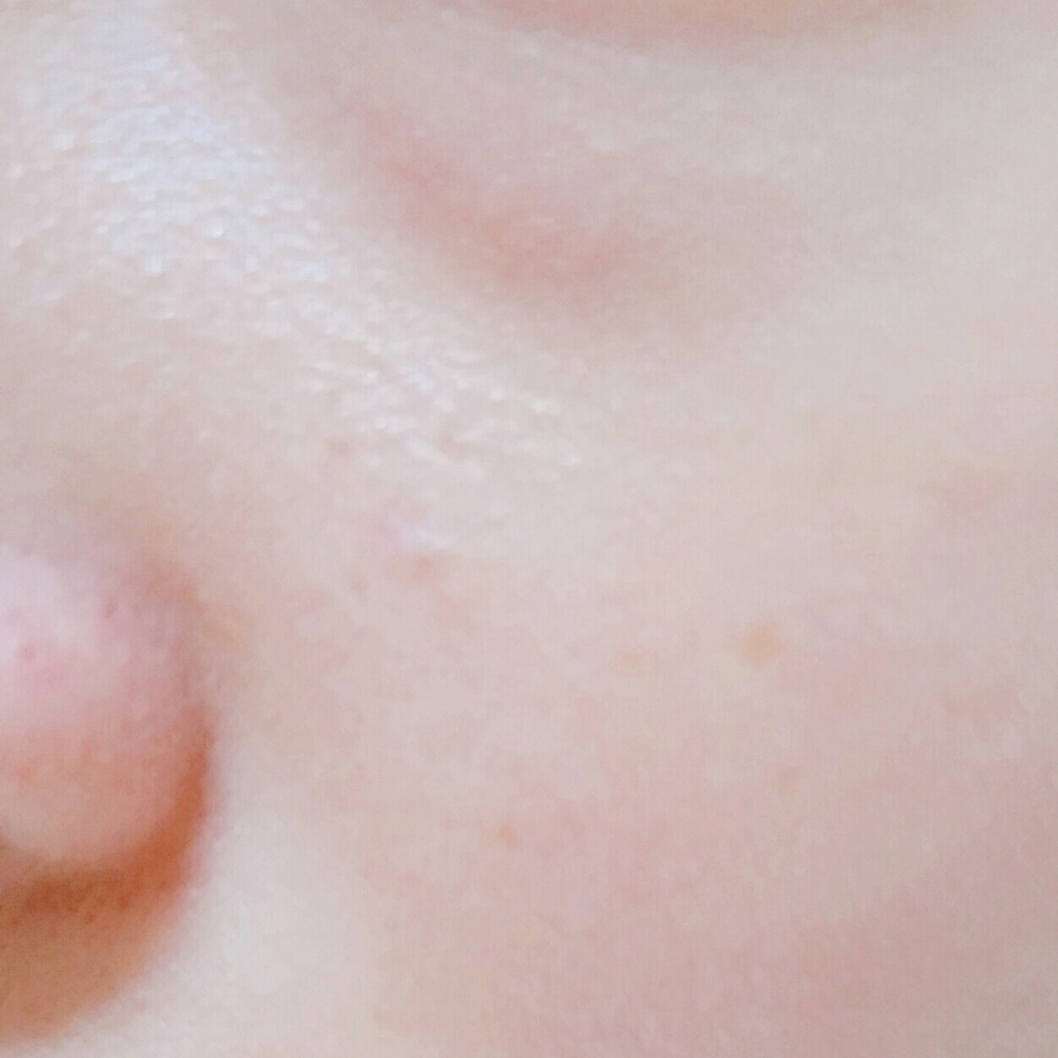 세안 전 피부 상태에요!

흐릿하게 나와서 잘 안 보이시겠지만
코 옆에 살짝 각질보이구 티존에 기름기도 있구
볼과 입 주변은 너무 건조한
제 혼란한 피부입니다ㅠㅠㅠ