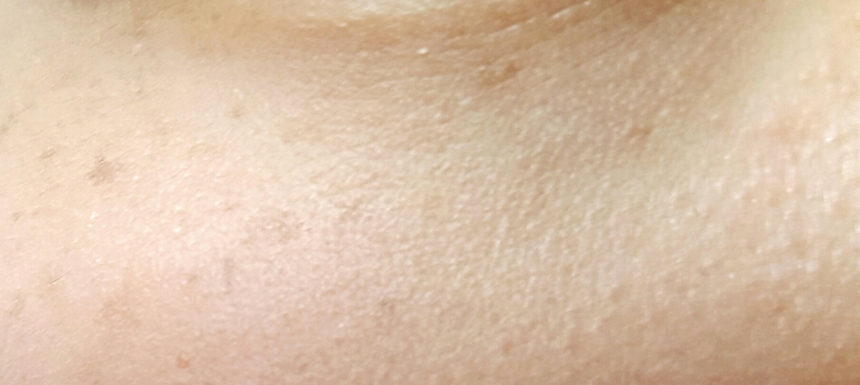 눈밑 다크서클 부분입니다