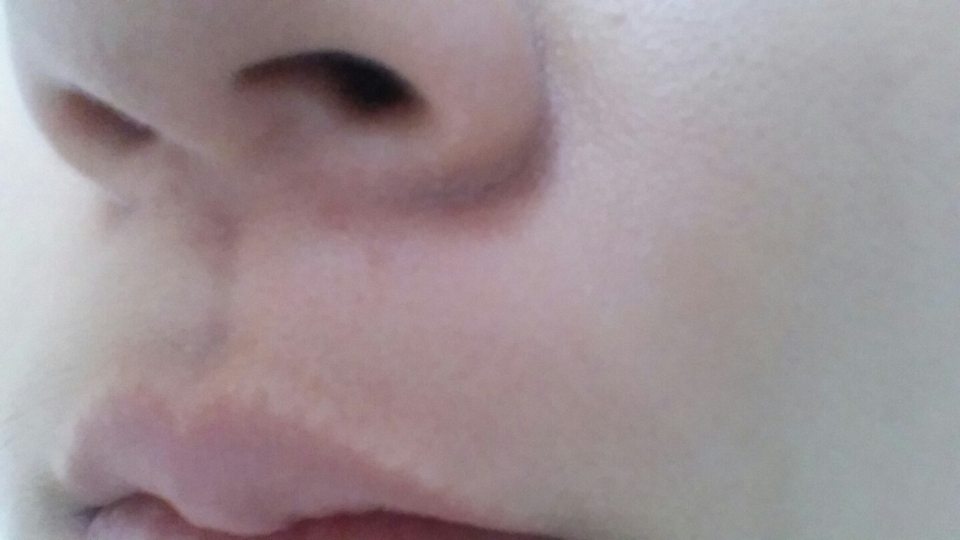 혐오주의!!ㅠ Before