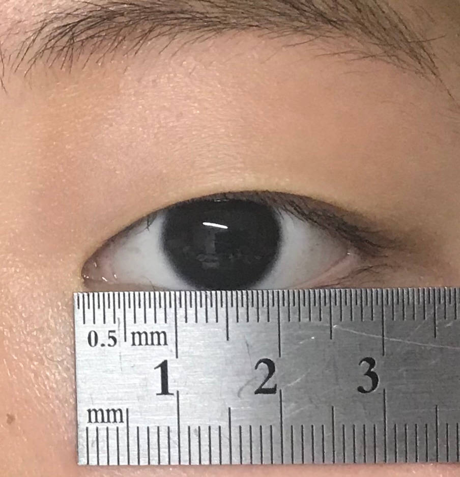 먼저 생얼인점.. 양해부탁드릴게요ㅠㅠ 일단 눈 앞머리에서 눈꼬리까지 자를 이용해서 몇cm인지 재어 줍니다! 저는 3이 제일 눈에 띄기 때문에 3cm를 눈 길이라고 칠게요!!