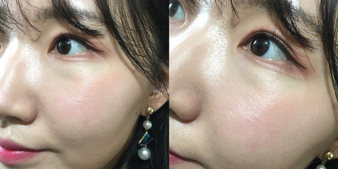 파우더블러쉬를 이용해 얼굴 전체를 가볍게 파우더 처리 해주었어요!!


아까보다 유분기가 훨씬 잡혔죠!!

카메라가 안좋아서 드라마틱한 효과가 안보이는 것 같아 아쉽지만, 
요 제품이 또 좋았던 점이 보통 이런 파우더 제품은 바르면 건조하다는 인식이 강한데 이제품은 그렇지 않았어요!


특히 코쪽 모공도 잘 채워주고,  딱 잡아야할 유분기만 잡아주더라구요❤️👍