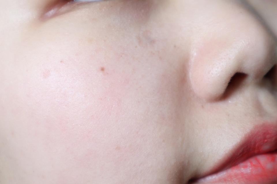 세안 하면서 얼굴에 자극이 없어서 좋았어요
전 버전은 씻어내리는 동안 굳은 아이가 피부에 마찰되어 힘들었는데!!

아니 넘 잘 씻기쟈나😭😭

피부결을 개선하는데 효과를 본 것 같아요! 모공 청소도 어느정도 살짝 있는것 같구요😉

저는 일주일에 두 번 꾸준히 사용할 템입니다!