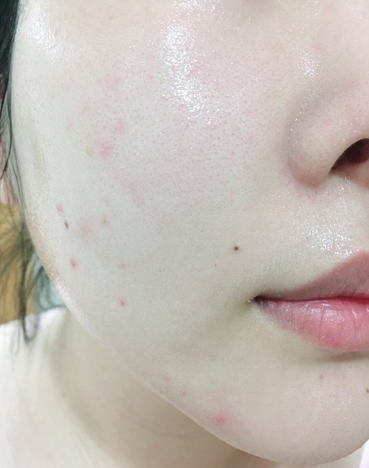 세안 후 발라봤는데 수분 공급이 제대로 됐어요
바른 후 시간이 지나도 얼굴에 광이 오래동안 유지되서 보통의 젤크림 처럼 빠르게 흡수되는 편은 아니에요 
지금껏 사용해봤던 젤크림과 달리 전혀 밀리지 않고 답답함 없이 보습력이 뛰어났어요
젤크림 이라고 해서 엄청 라이트 할거라 생각했는데 의외네요
저는 평소에 건조함이 없는 중성 피부라서 겨울까지도 이거 하나로도 괜찮을것 같아요
정말 마음에 들었던 점은 밀림현상이 없어서 이 위에 메이크업 하기에도 문제 없다는 거에요! 
끈적임이 없다는 사람도 있었는데 아예 없는건 아니고 끈끈한 느낌은 살짝 있어요 하지만 끈적임이 심하지 않아서 크게 거슬리지는 않았어요 
출시 후 저는 곧바로 아쿠아 레오티에 울트라 서스트 퀸치 크림과 에센스를 먼저 사용해 봐서 별 기대 안했는데 개인적으로 크림 보다는 젤크림이 훨씬 더 만족스러워요👍🏻
아쿠아 레오티에 라인 전부 다 똑같은 향이 나는데 비누향수 냄새 같기도 하고 중성적인 느낌의 상쾌한 향이 나는데 저는 평소에 정말 좋아하는 향이라 만족하지만 중성적인 향 싫어하시는 분들은 아쿠아 레오티에 향이 좋지 않을수도 있으니 참고해 주세요 