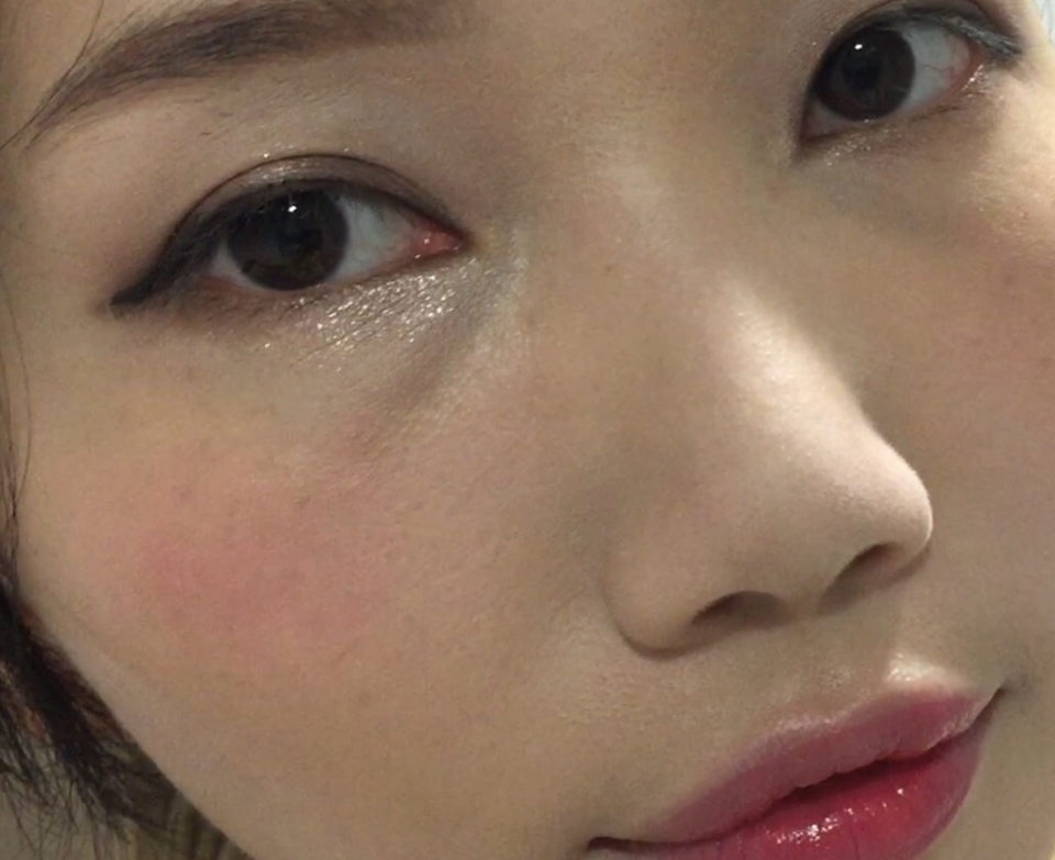 整臉看