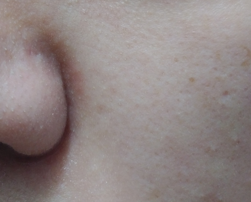 전.후 차이가 보이시나요? 꾸준히 사용해줘야 될 거 같아요^^