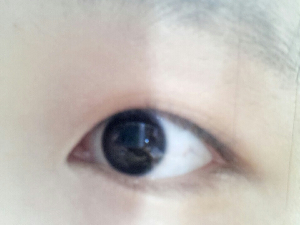 이건오른쪽눈!!이렇게