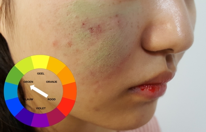 붉은 여드름과 흉터, 홍조에 얇게 도포해 스폰지로 밀착시켜 톤을 보정해줍니다.
*컬러 코렉팅은  보색효과를 사용하여 톤보정을 해주는것으로 붉은 곳에는 그린색을 사용해줍니다. 
*꾸덕한제형의 경우 넓은부위보다는 좁게 사용하는게 좋아요!