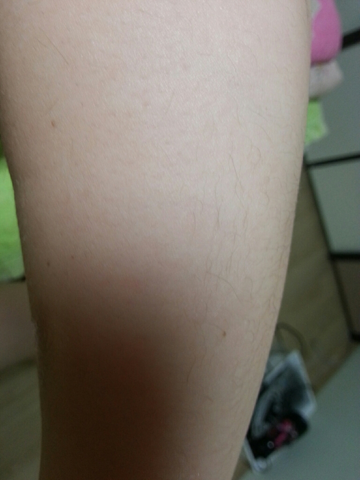 제모는 제모할부위를 물로뭍이고, 제품에도 물을뭍인뒤 슥슥밀어주면되요! 하나도안아프고 진짜부드러워요ㅠㅠㅜ제모한부분이 아래고 위에는 안했어요! 차이가크죠ㅎㅎ