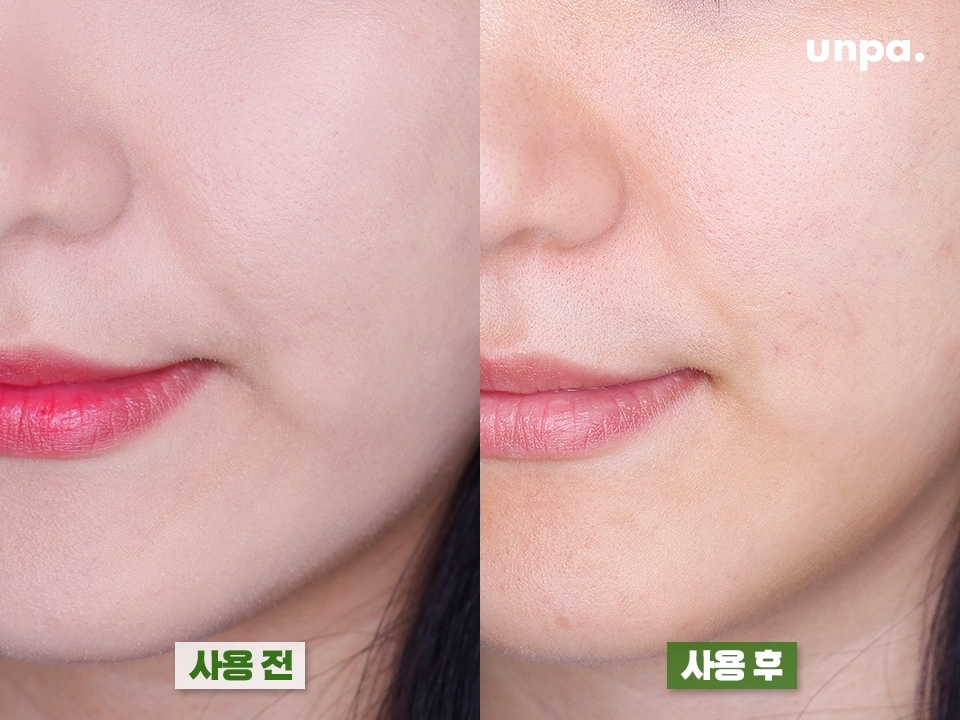 건성이라도 코, 볼, 턱 주변 오돌토돌 돌출 피지가 고민인데
모공까지 딥 클렌징해주니 메이크업부터 피지까지 순-삭!
항상 세안하고 나면 누가 잡아당기듯 미친듯이 건조했는데
건성 피부의 최대 고민, 속건조! 전 이렇게 해결했습니다 (뿌듯)
