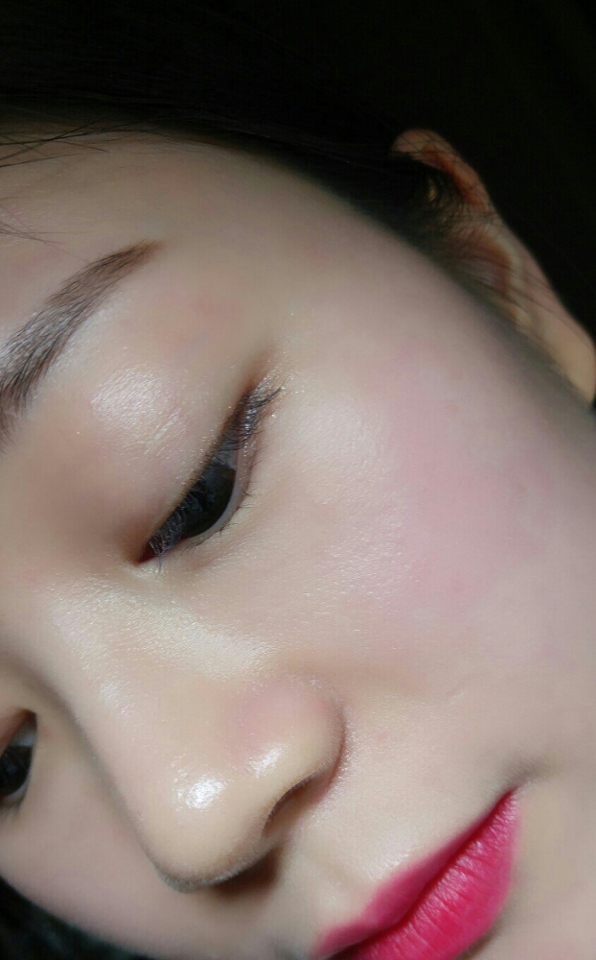 볼에 홍조 보이시죠?? ㅠㅠ겨울철 실내가 부담스러운 피부. . 😭