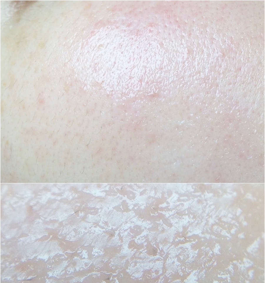 




흡수가 빠른 편이며 

산뜻 마무리되면서 부드러운 

피부 결 정돈을 도와준다.

​

그리고 보습감을 도와줘서 

부들 보들 촉촉한 느낌 !!

​

겨울 앰플로 사용하면 

넘 좋을 것 같음 ! 

​

:)
