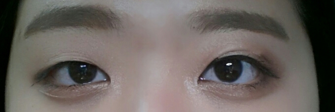 전 후 ㅋㅋㅋㅋㅋ 쌍수를 해야하나 고민중이에요.