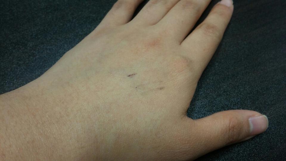 립앤아이리무버로 지운 모습이에요. 1차로 닦아냈는데 잔여물이 꽤 남아있죠. 꼼꼼한 클렌징이 필수입니다.