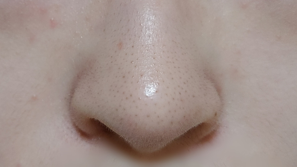 먼저 제 코 상태는 사진과 같아요..! 

블랙헤드가 생각보다 많더라구요.. 모두의 고민이 아닐까싶네요 ㅋㅋㅋ
오늘 뷰티팁은 아무래도 블랙헤드다 보니 코 사진이 다에요 
★ 보기 싫으신 분들은 보시지않는걸 추천드려요 ★ 
