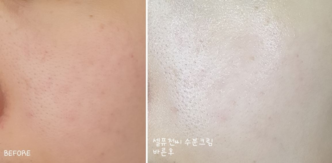 유분이나 겉도는 느낌, 끈적함 없이 수분감도 정말 좋고~
알콜성이 별로 느껴지지 않아 수분이 잘 유지되거든요.
민감성이 아니라 일반 피부라면 정말 이 가격대에 구할 수 없을 만큼 좋은 수분크림이라고 추천드리고 싶어요.
