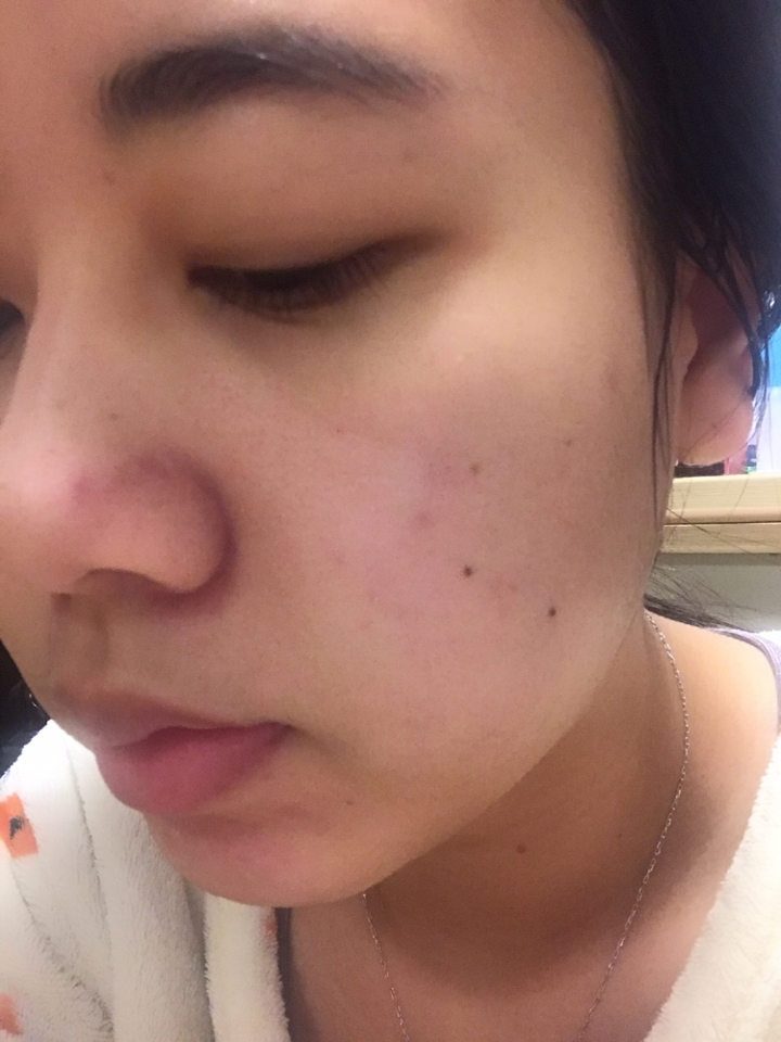 팩을 한 후에요! 
확실히 촉촉해지긴 했지만, 엄청~~~! 난 촉촉함은 아니었구요!  토너 하나로는 약간 땡겼습니다
이미지처럼 완전 그냥 무자극! 무향! 이었어요
얼굴이 간지럽거나, 붉어지거나, 부풀어오르거나 하는거 없이 정말 무자극 무향 깔끔 그자체!

공병에 미스트대용으로 쓰기도 좋은 것 같아요!
여름에 특히 깔끔해서 좋을 것 같습니다만, 이런 한파의 겨울날씨에는 보습이 약간 아쉬웠습니다!
그냥 닦아쓰는 토너로는 완벽한 것 같아요!
닦아쓰는 물토너가 너무 보습이 세거나 오일리하면 다음에 스킨 이나 로션이 잘 안먹더라구요!

🌹🌹🌹그리고 피지랑 , 약간 나와있는 블랙헤드를 없애주는 효과는 있는 것 같아요!! 제가 기존에 쓰는 토너보다 그 효과가 뛰어난 것 같습니다!

참고해주셨으면 좋겠습니다 ㅎㅎ
이만 리뷰 끝!

이 리뷰는 라운드랩에서 무상으로 제품을 받아, 솔직하게 작성된 리뷰입니다.