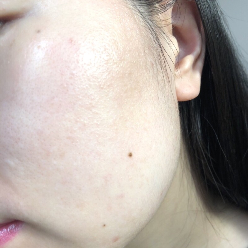 요즘 밤마다 뿌리고 자는데 진짜 바르고 화하더라구요?
분사 전보다 훨씬 광채가 돌았어요.

제가 너무 좋아하는 히알루론산이 함유됐다는데
그래서인지 수분감도 너무 좋았고요 ㅎㅎ


저는 어떤 기초케어도 바른 뒤에 끈적이는 건
너무너무 싫어요!!! 특히 여름인데ㅜ 그건 진짜 never..
듀이미스트는 다행히 그런 느낌 없이 시원하고 산뜻한 느낌이 들면서 윤기가 돌더라고요