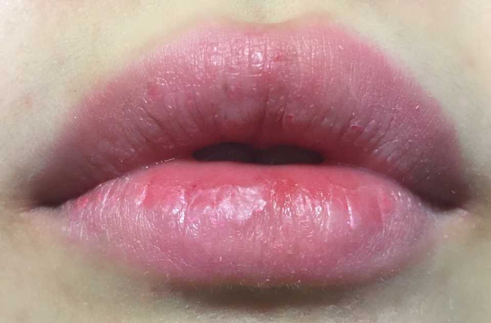 그렇담 립 발색을 안 볼 수 없ㅈ겠죠??ㅎㅎㅎ
우선 아무것도 바르지 않은 입술입니다 ..!

언파 부비부비립으로 어느정도 각질정리한건데ㅜㅜ지저분해보이네용 ,,


