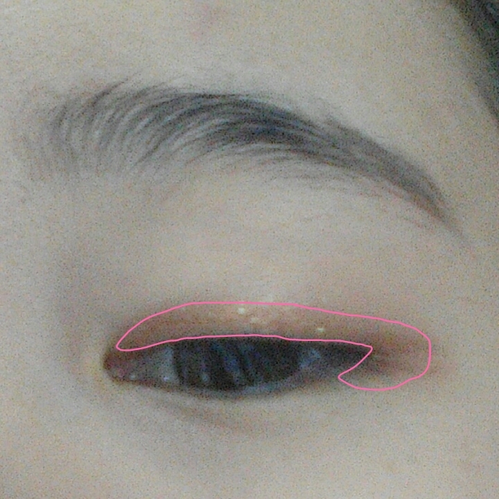 기적의달의요정을 속쌍부분에 바르셔요