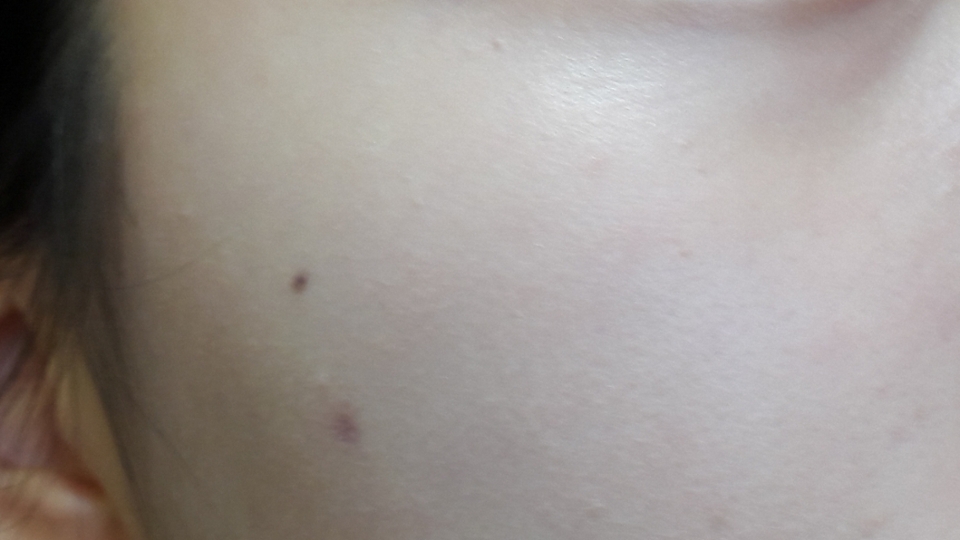 애프터!! 정말 사진상엔 차이가 안보여서 좀 그런데..ㅠㅠ 정말 차이가 있거든요 확실히 미백있고 지운다고 물에 벅벅문질러도 안지워져요!! 클렌징폼으로 세안하면 싹 지워져요
아 그리고 미간, 코, 입 주변 부분이 건성이라 뭘 발라도 좀 뜨는데 이것도 뜨더라구요 ㅠㅠㅠㅜ그게좀 아쉬워요 근데 학교에서 화장못하게하고 할 시간도 없는지라 이것만 딱 발라도 좋을것같아요😃😃

이상 백산슈 후기였습니다
궁금하신점은 댓글로 남겨주시고 좋아요 부탁드려요💙