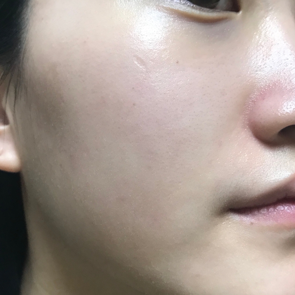 픽서를 얼굴에 바른 모습입니다! 
역시 발림성은 뻑뻑하지 않고 얼굴에 고르게 발렸으며 핑크색 베이스인 만큼 얼굴이 조금 톤업되고 환해지는 느낌이에요❤️ 