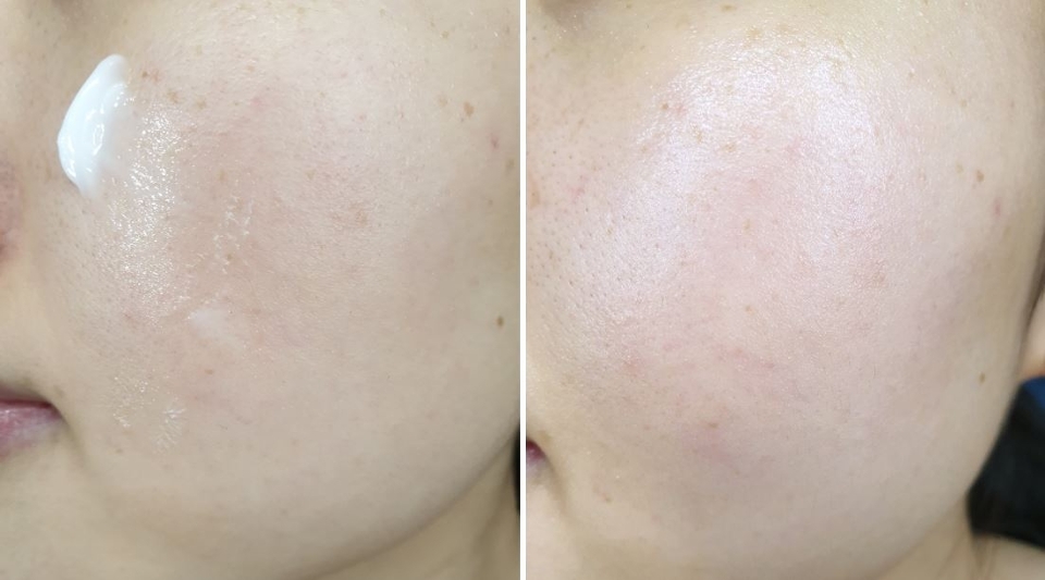 피부에 바르면 쏙 흡수되어 탱글한 탄력만 남기고 끈적임이 없더라구요. 
함께 오는 스패츌러는 크림통 안에 위생적으로 보관할 수 있어서 좋았어요. 자몽향이 상큼해요. 위에 2가지 크림보다 보습 지속력도 높은데다가 시간 지나 피부 유분기도 덜 나와요.
