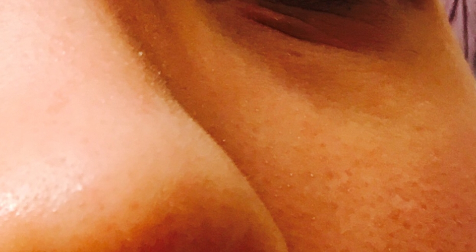 화-한 느낌이 들면서 10분동안 피지를 불린 후 패치를 벗기면
이렇게 하얀 볼 속에 박힌 피지들이 쏙쏙 올라와있어요!

