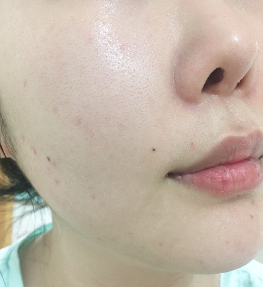 세안 후 곧바로 분사했어요 
플로럴향, 시트러스 향이 느껴지는 아로마 향인데 사용할때마다 마음을 편안하게 해주고 가볍고 상쾌해요 
분사력이 정말 안좋지만 내용물 만큼은 제가 지금껏 사용했던 미스트 중에서는 가장 좋았어요 
물타입 미스트인데 정말 촉촉하고 끈적임이 없거든요 
용량에 비해 가격도 비싼데 용기만 리뉴얼 된다면 너무 좋을것 같아요 