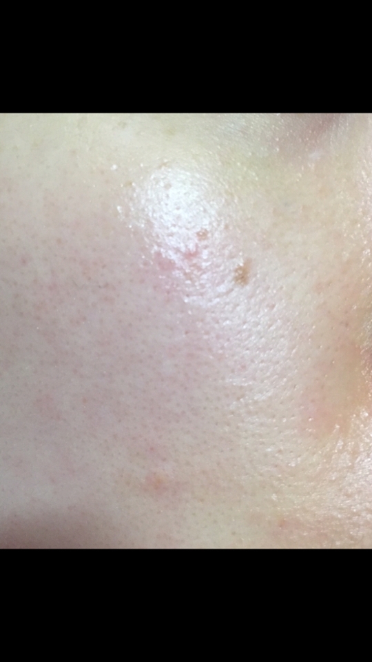 얼굴에 바르자마자 곧바로 부드러워지구 펴바른 손바닥도 너무 부들부들합니당💕💕
리뷰를 위해 일부러 이거 하나만 바르고 벼텼는데 보드라움이 많이 오래가진 않았지만 속건조도 약간 해결되는 것 같아요 