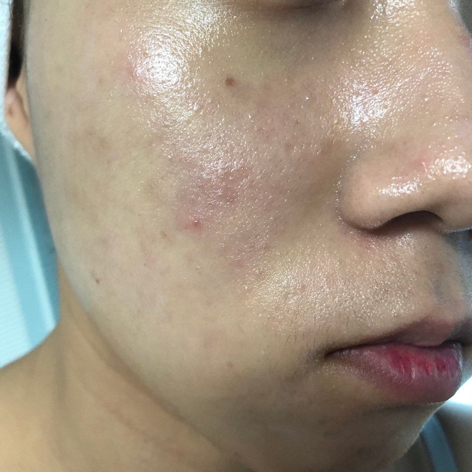 백탁현상은 조금 있고 굉장히 촉촉해용!