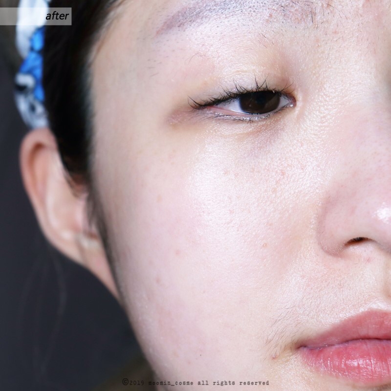 저는 악건성이라 지금 사용하고 있는데는 전혀 불만이 없지만

지성이신 분들은 좀 고려를 하셔야할 것 같아요!

​

저도 여름이 다가오면 진정케어로 쓸때는 주로 밤에 사용하고

스페셜케어로 사철쑥크림 드음~뿍 올려서 수면팩으로 사용하려구요!

여름만 지나면 악건성인 저에게는 아주 그냥 찰떡인 크림 이지만요!

​

꾸준히 사용해본 결과

미라클하게 효과가 나오지는 않지만

홍조감이 확실히 많이 옅어졌고 밤만 되면

볼만 새빨갛던 볼빨간혜용스의 빈도가 반 이상으로 줄었다는거에요!

​

그리고 여드름이 바로 싸악~ 가라앉지는 않지만

평소에 여드름이 나면 최소 일주일은 가고

여드름 흉터도 무조건 남는 편이었는데

​

일주일 전에 여드름이 농익고 알아서 사라져서

흉터가 남지 않았다는거! 

​

확실히 이런 부분에서는 효과를 본 것 같아요!

제형 자체는 유분감>>>수분감 이라서

#올리브영 에서 미리 테스트해보시고

본인 피부타입에 맞게 구매결정을 하시는걸 

저는 제일 추천드려요!

​

그럼 20000물러날게요!

​

뿅!

​