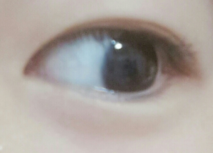 Y자스틱이 처음하시는 분들에겐 아플수도있어요!
그땐 면봉을 사용해주시면 굿입니다 면봉은 부드럽고 라인잡기에도 좋아요~ 그리고  전 Y자스틱에 Y부분 사용안합니단! 전 뾰족한부분을 사용해서 라인을 만드시는게 훨씬 편하더라구요! 눈알튀어나올걱정도 없어요ㅎ