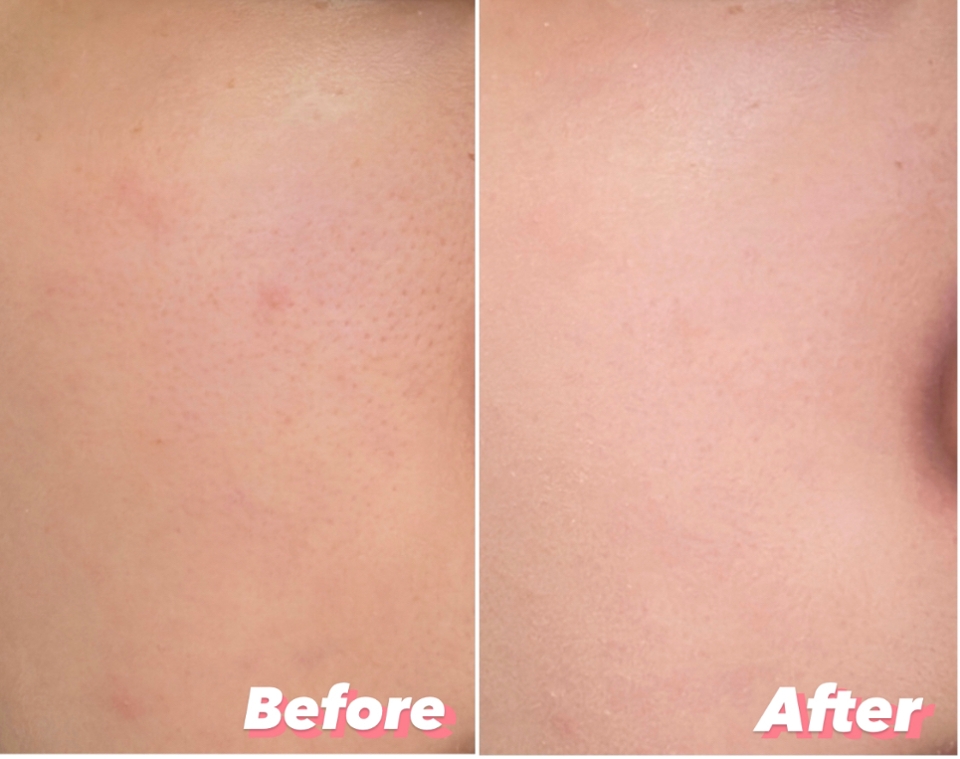 [최종 비교사진]