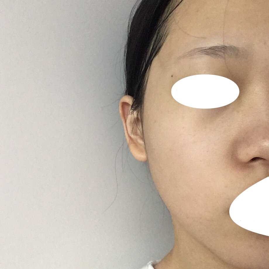 세안후의 얼굴입니다! 피부 사진은 전부 무보정에 같은 장소에서 찍었어요 얼굴이 환해졌고 굉장히 촉촉한 상태예요