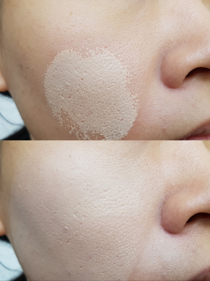 
얼굴에 노란끼가 많이 도는 타입이지만, 
홍조 때문에 나비존 부근은 붉은끼가 있는 피부에요. 

보시다시피 한 번의 터치 만으로도, 
노란끼와 붉은끼를 적절히 중화시켜주는 점이 매력적이었답니다-❤

그리고 보시다시피 유분감 없이, 
보송보송한 마무리:)

여름엔 뭐니뭐니해도 세미매트한 쿠션이죠~👍
그렇지만 자칫하면 각질부각이 심하게 될 수 있는 게 세미매트 제품의 큰 단점인데, 
삐아의 스파광 롱웨어 쿠션은 각질부각이 없더라구요!

아마 바르고 난 직후부터 펴바르기 전까지의 풍부한 수분감 덕분인 것 같았어요~😍

그렇지만 한 가지 아쉬운 점이 있다면 
모공 커버가 잘 안 된다는 거.....😭😭

처음에는 촉촉하게 발리지만 퍼프로 톡톡 두드리며 펴바르면, 
파우더 처리를 하는 것 마냥 픽싱이 됐어요. 

​그런데 이때 모공과 요철을 메꾸어준다는 느낌보다는 
얇은 막을 형성시키듯 밀착이 되는 느낌이라서 
모공 커버가 거의 되지 않는다고 느꼈어요...
저처럼 왕모공!!!의 소유자이신 분들께서는 포어 프라이머를 필수로 사용하셔야 할 것 같아요. 


참고로 지금까지 파운데이션+납작브러쉬 조합 외에 제 왕모공을 커버해주는 쿠션 타입을 만나본 적이 없는지라, 
삐아의 스파광 롱웨어 쿠션의 모공 커버력이 낮다!!!! 라고는 할 수 없을 것 같아요.

맞습니다......
모공은 오롯이 제 자신과 싸워야할  문제인 것이죠~😭😭

모공 고민이 없는 분들께는 분명 여름 인생템으로 등극 할 수 있는 쿠션이에요. 
모공 이외의 피부 고민에 대한 커버력은 우수했거든요! 
또한 "내가 이걸 발랐었나?" 긴가민가한 생각이 들 정도로 
얇고 가볍게 발리는 마무리감도 굉장히 마음에 들었어요. 

여름엔 뭐니뭐니해도 얇게 발리면서도 보송보송한 쿠션이 최고!🙌😍


