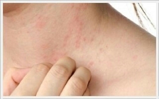 클렌징을 사용할 때에도 피부 타입에 따라 다양한 제품들을

사용해주는 것이 좋습니다. 건성의 경우에는 촉촉한 제품을

지성의 경우에는 유분감이 적인 제품, 민감성의 경우에는

순한성분의 클렌징제품을 이용하는 것이 좋습니다.

