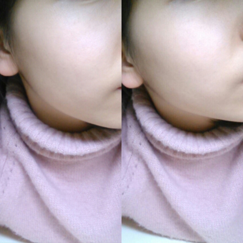 바르고나서! 비포보다 훨씬 밝게나왔죠!?😁ㅋㅋㅋㅋ

평소 뭘 바르면 자주 따가워서 크림을 바를 때 피부에 자극이 될까봐 걱정하는데
이거는 순해서 그런지 전혀 따갑지 않았어요!💕

또 정말로 피부가 진정되는 느낌을 받았어요! 피부 진정은 정말 굿👍