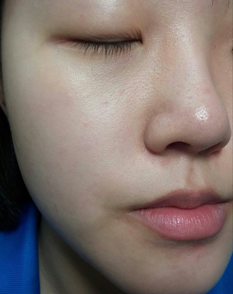 쌩얼ㅎㅎ
코밑 붉은기, 뾰루지, 얼룩덜룩한 피부톤,요철, 블랙헤드가 눈에 띄네요..