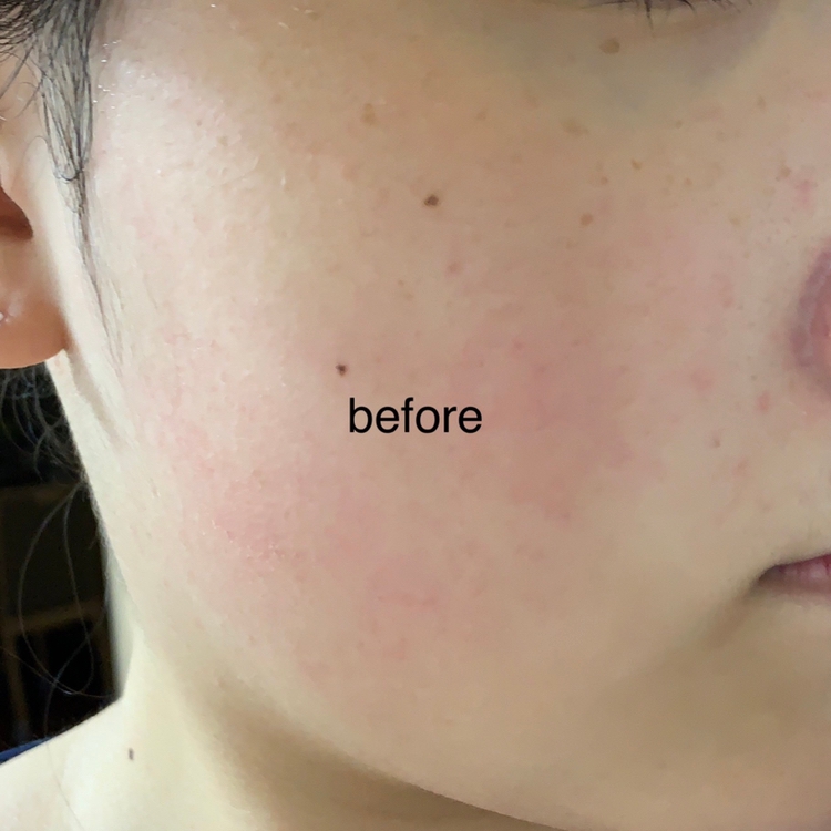 토너 사용하기 전 사진입니다.