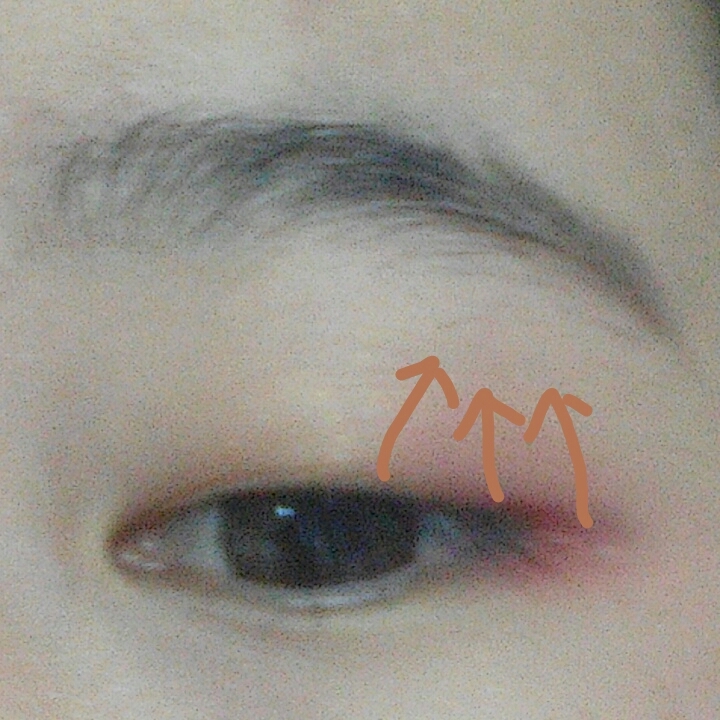 정글레드 역시퍼진다는 느낌으로 해주세욤