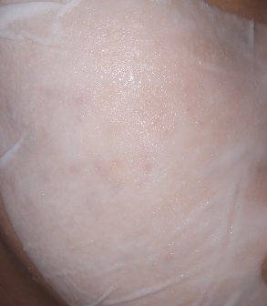 마스크팩을 붙였을 때에요! 되게 얇은 마스크팩이였어요! 밀착력 진짜 장난아니에요..👍👍 사실 제가 이 마스크팩을 붙히면서 되게 고민했던 점이 바세린 퓨어 스킨 젤리 오리지널을 사용하신 분들은 아시겠지만 약간 꾸덕꾸덕하면서 끈적한 감이 약간 있잖아요 그래서 마스크팩도 끈적거리지않을까 되게 고민을 했는데 끈적이는거? 진짜 없어요!! 오히려 촉촉하다라고 느낄 정도였어요! 또 제가 이걸 책상 서럽에 넣어났었는데도 시원하더라구요! 쿨링효과도 약간 있는 제품인 거 같아요!!