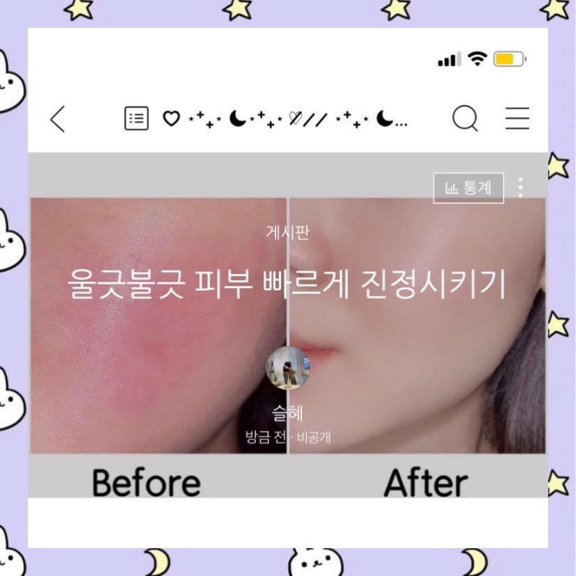 마스크 때문에 그런지 피부에 울긋불긋하게 
홍조랑 붉은끼,트러블이 많이 올라와서 고민이었는데 
집에서 간단하게 고민해결 끝‼️

<자세한 내용은 사진 참고 부탁드려요>