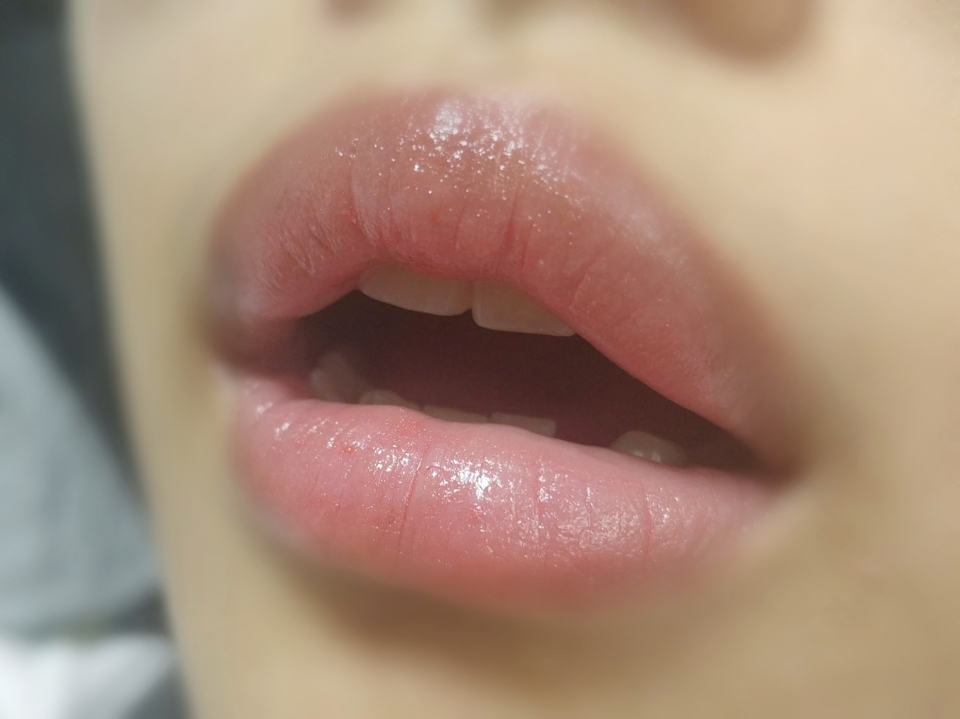 입술에 한 14번정도 발라주었어요😅

발색은 이 이상으로는 안나오더라구요

원래의 입술색을 덮어주지는 못히요



그나저나 바르자마자 확 풍기는 스트로베리향... 🍓

체리향같기도 한데 향이 엄청 세네요 ㅇㅅㅇ...

생각보다 세요

틴트처럼 시간가면 날아가는 향이아니고 쭉 남아있네요!