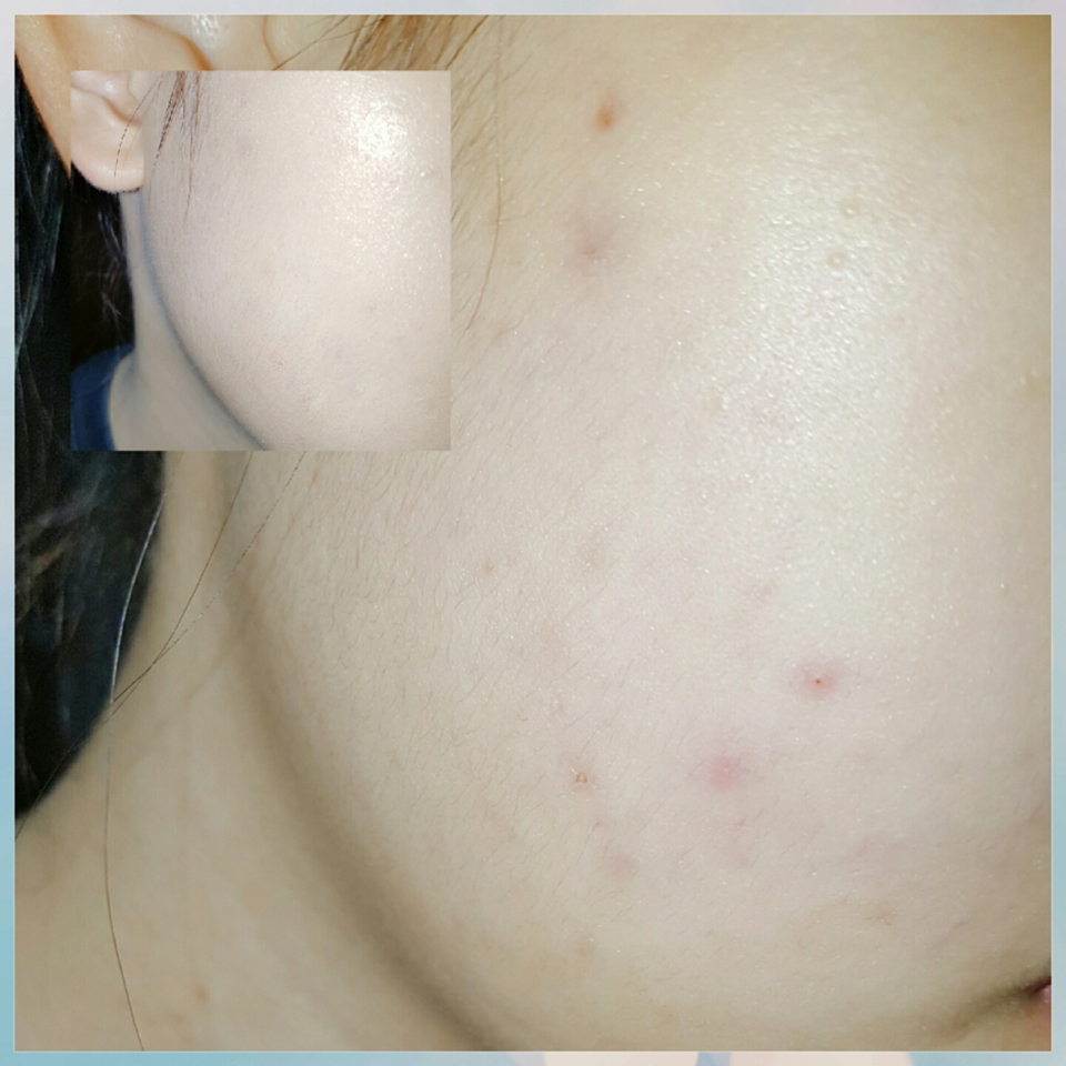 다시한번 비포애프터 후..☆